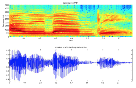 SpectrogramVsWaveForm_AD1.jpg